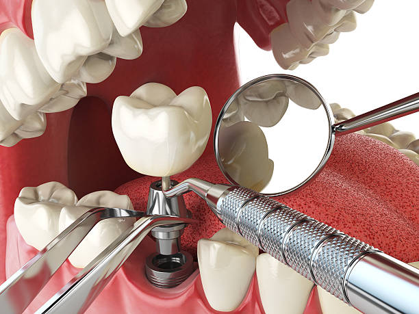 Best Emergency Treatment for Toothache in Decatur, MS